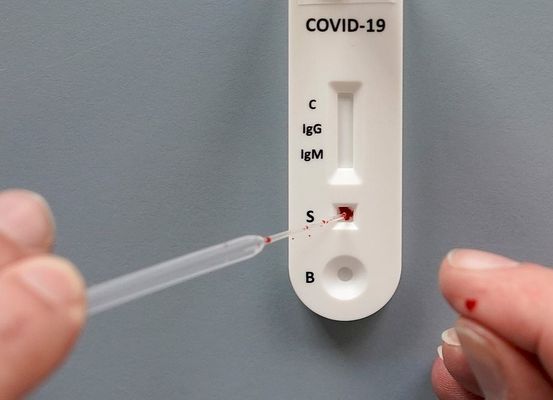 Irecê registra primeiro caso confirmado do novo coronavírus